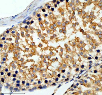 Immunohistochemical staining of SLC6A16 using anti-SLC6A16 antibody. SLC6A16 was detected in a paraf