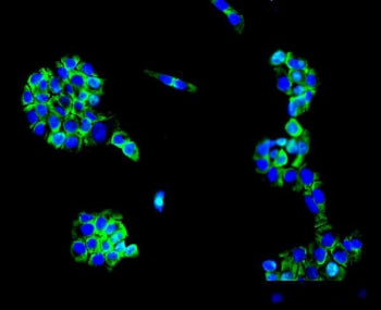 Immunofluorescent staining of FFPE human A431 cells with MC4-R antibody (green) and DAPI nuclear sta