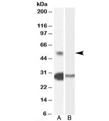 Western blot testing of human testis lysate with TCFL5 antibody at 0.3ug/ml with [B] and without [A]