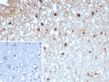 IHC staining of FFPE human brain tissue with GLUL antibody (clone GLUL/8996R). Inset: PBS used in pl