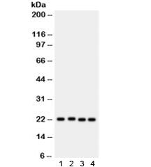 Western blot testing of 1) rat PC12, human 2) SW620, 3) HeLa and 4) MCF7 lysate with SOCS2 antibody.