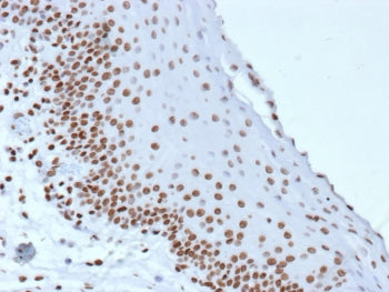IHC staining of FFPE human tonsil tissue with Phosphorylated Histone H3 antibody (clone rHH3/9924). 