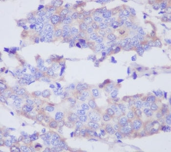 MMP2 Antibody