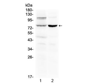Dishevelled 2 Antibody / DVL2