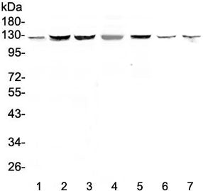 Western blot testing of human 1) HeLa, 2) HepG2, 3) PANC-1, 4) SK-OV-3, 5) COLO320, 6) rat testis an