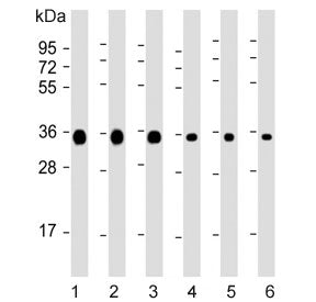 Western blot testing of 1) human HeLa, 2) human Jurkat, 3) human A549, 4) rat C6, 5) mouse NIH 3T3 a