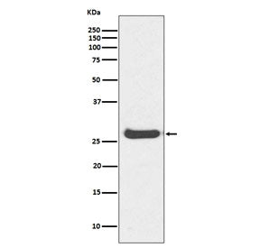 Western blot testing of human kidney lysate with Histone H1.0 antibody. Predicted molecular weight ~