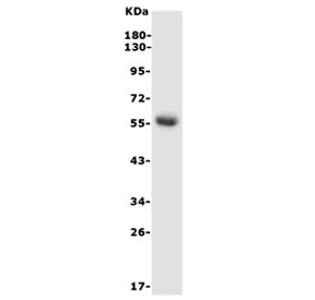 Western blot testing of rat kidney lysate with Hexosaminidase A antibody. Expected molecular weight: