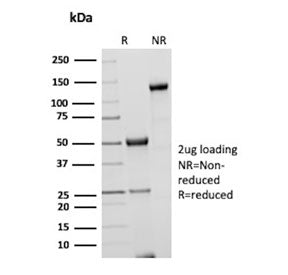SDS-PAGE analysis of purified, BSA-free CSTA antibody (clone rCSTA/8995) as confirmation of integrit