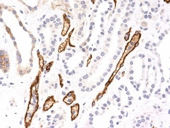 IHC testing of FFPE human kidney transplant with Complement 4d antibody (SPM545). Required HIER: boi
