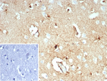IHC staining of FFPE human brain tissue with GLUL antibody (clone GLUL/8619R). HIER: boil tissue sec