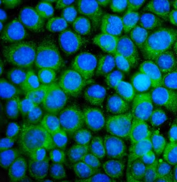 Immunofluorescent staining of FFPE human MCF7 cells with BAK antibody (green) and DAPI nuclear stain