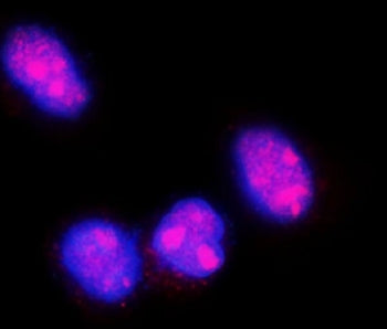 Immunofluorescent staining of FFPE human SiHa cells with FGF2 antibody (red) and DAPI nuclear stain 