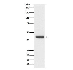 Western blot testing of rat C6 cell lysate with Doublecortin antibody. Predicted molecular weight: 4