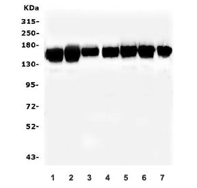 Western blot testing of human 1) K562, 2) HL-60, 3) U-2 OS, 4) U-87 MG, 5) HepG2, 6) ThP-1 and 7) A5