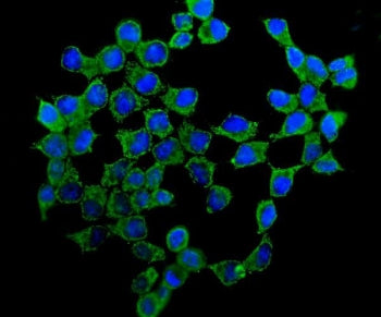ATP5H Antibody