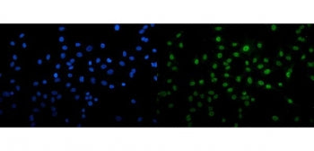 Immunofluorescent staining of FFPE human A549 cells with U2AF2 antibody (green) and DAPI nuclear sta