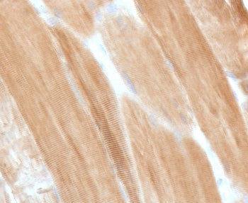 IHC staining of FFPE skeletal muscle with Dystrophin antibody (clone DSTN-1). HIER: boil tissue sect