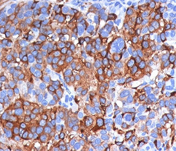 MART-1 / Melan-A Antibody