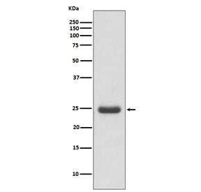 Western blot testing of human Molt4 cell lysate with TK1 antibody. Predicted molecular weight ~25 kD