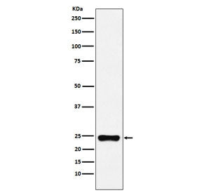 Western blot testing of human HeLa cell lysate with BAG2 antibody. Predicted molecular weight ~22 kD