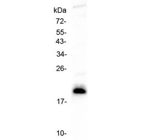 Western blot testing of human CCRF-CEM cell lysate with IL-4 antibody at 0.5ug/ml. Expected molecula