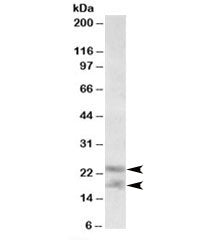 Western blot testing of human prostate lysate with IL-25 antibody at 0.3ug/ml. Predicted molecular w
