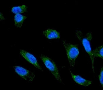ADIPOR1 Antibody