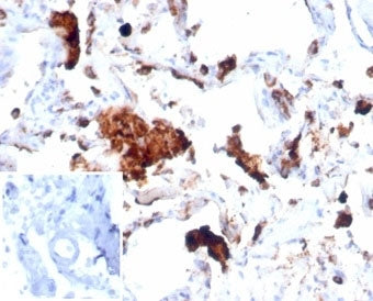 Napsin A Antibody