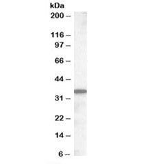 Western blot testing of mouse small intestine lysate with Slc10a2 antibody at 0.5ug/ml. Predicted mo