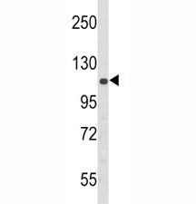 PERK Antibody
