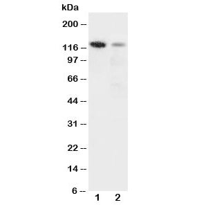 Western blot testing of Integrin alpha 3 antibody and Lane 1: rat heart; 2: HeLa cell lysate. Expect