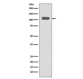 Western blot testing of human spleen lysate with ITGB3 antibody. Expected molecular weight: 87-110 k