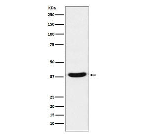 Western blot testing of human A431 cell lysate with VPS26 antibody. Predicted molecular weight ~38 k
