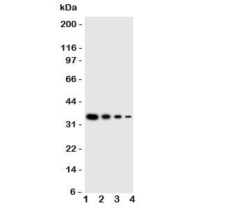 Western blot testing of LAT2 antbody; Lane 1: Recombinant human protein 10ng; 2: 5ng; 3: 2.5ng; 4: 1