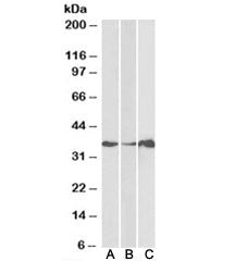 Western blot testing of human cerebellum [A], colon [B] and duodenum [C] lysate with LASP1 antibody 