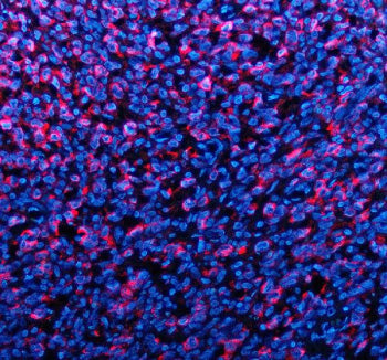 Immunofluorescent staining of TYRP1 using anti-TYRP1 antibody (red). TYRP1 was detected in a paraffi