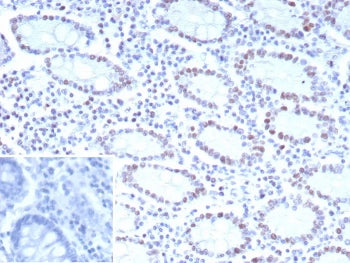 IHC staining of FFPE human colon tissue with CDK4 antibody (clone CDK4/8895). Inset: PBS used in pla