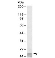 Western blot testing of human skeletal muscle lysate with SCOC antibody at 0.1ug/ml. Predicted molec