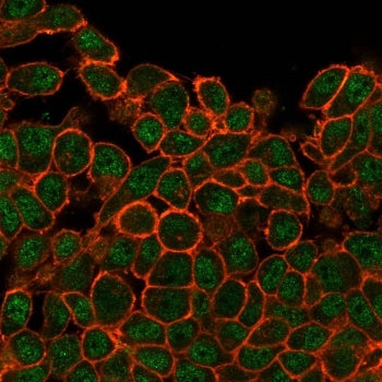 Immunofluorescent staining of PFA-fixed human HeLa cells with SATB1 antibody (green, clone PCRP-SATB