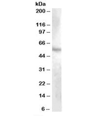 Western blot testing of human kidney lysate with DMP1 antibody at 1ug/ml. Predicted molecular weight