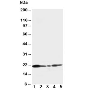 Western blot testing of Caveolin-1 antibody and Lane 1: U87; 2: HeLa; 3: MCF-7; 4: A549; 5: HT1080 cell lysate. Predicted molecular weight ~21/17kDa (alpha/beta isoforms)