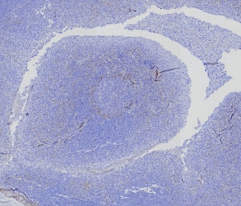 BCMA Antibody / CD269 / TNFRSF17
