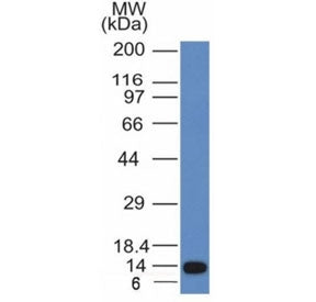 ALK Antibody / Anaplastic Lymphoma Kinase