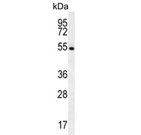 Western blot testing of human NCI-H460 cell lysate with GSR antibody. Predicted molecular weight ~56