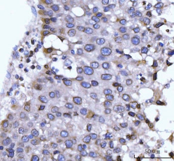 IHC staining of FFPE human liver tissue with NUP210 antibody. HIER: boil tissue sections in pH8 EDTA
