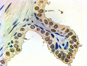 IHC staining of FFPE human prostate with Androgen receptor antibody at 2ug/ml. HIER: steamed with pH