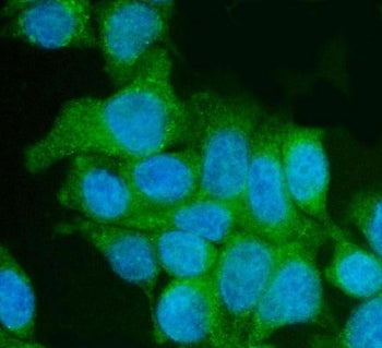 Immunofluorescent staining of FFPE human Caco-2 cells with Utrophin antibody (green) and DAPI nuclea