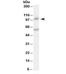 Western blot testing of human peripheral blood mononucleocyte lysate with NOD2 antibody at 0.1ug/ml.