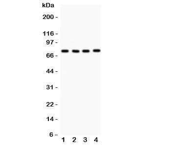 Western blot testing of PKC alpha antibody and Lane 1: rat brain; 2: mouse brain; 3: (m) heart; 4: h